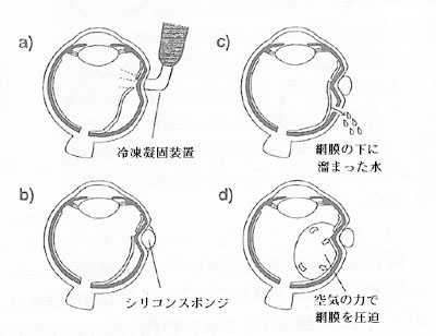 ihfig69