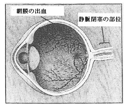 ikfig1 ikfig1