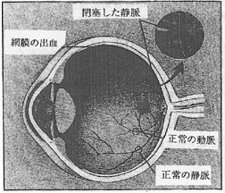 ikfig2 ikfig2