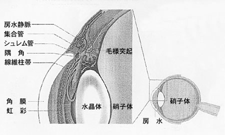iqfig1