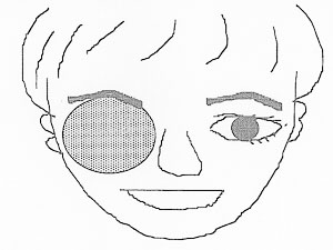 isfig1