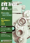 news17-00s